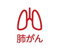 肺がんリスク